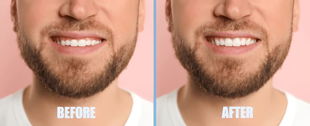 gum contouring near you