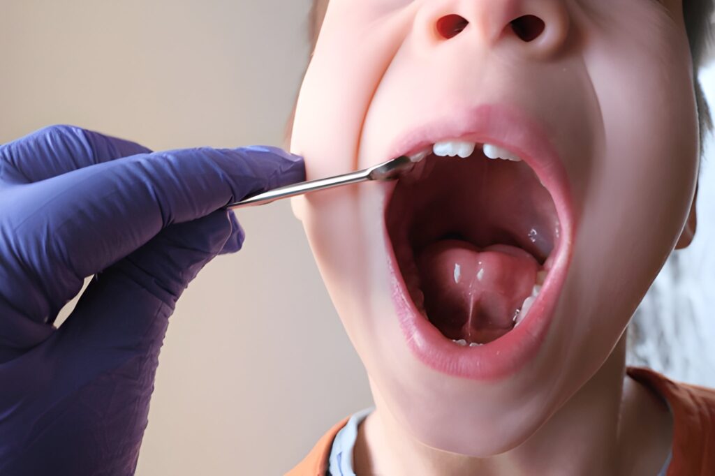 tongue tie treatment near you