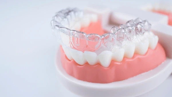 SureSmile-img-01